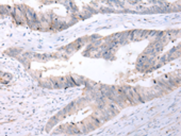 Rabbit Polyclonal Antibody to P2RY12