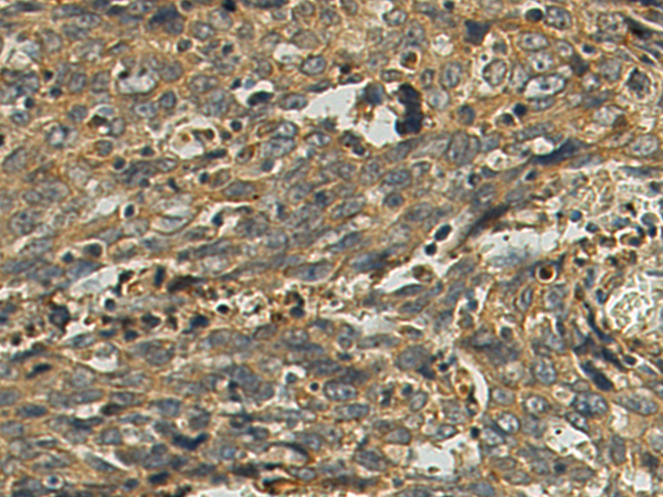 Rabbit Polyclonal Antibody to ORAI1(L1)