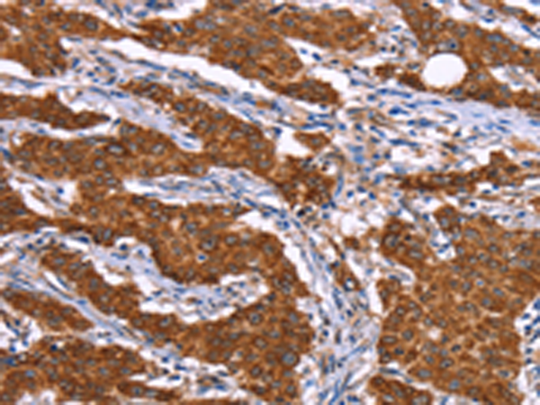 Rabbit Polyclonal Antibody to RPS6KA6
