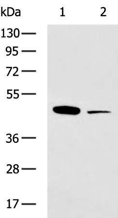 Rabbit Polyclonal Antibody to SGK2