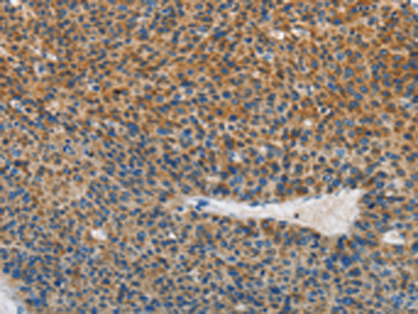 Rabbit Polyclonal Antibody to SGK1