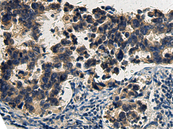 Rabbit Polyclonal Antibody to BOK(BH3 domain)