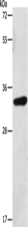 Rabbit Polyclonal Antibody to MAGEA3
