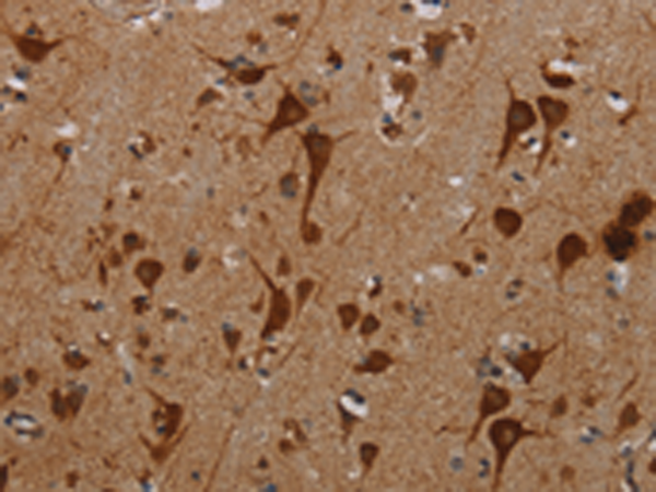Rabbit Polyclonal Antibody to KMT2D