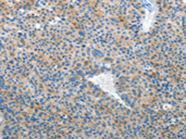 Rabbit Polyclonal Antibody to EPHB3