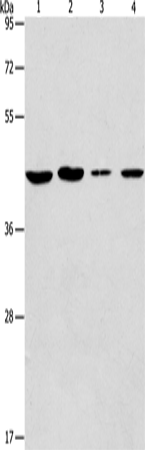 Rabbit Polyclonal Antibody to PRKX