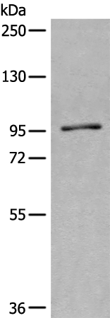 Rabbit Polyclonal Antibody to SMG8