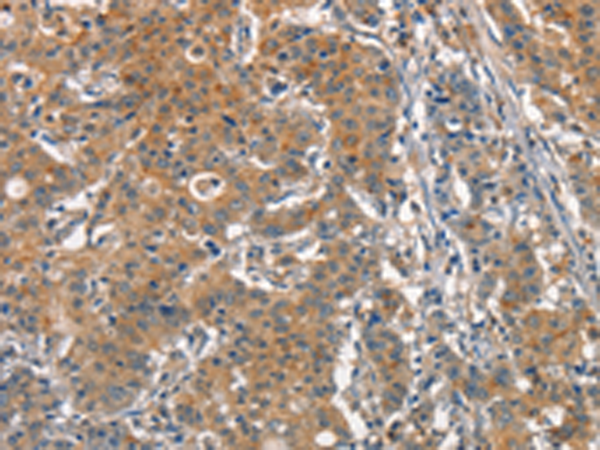 Rabbit Polyclonal Antibody to ACP4