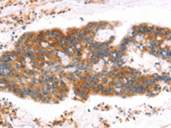 Rabbit Polyclonal Antibody to AFDN