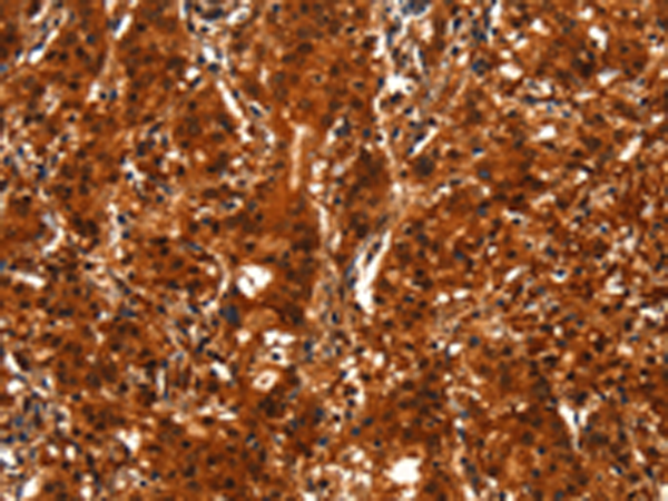 Rabbit Polyclonal Antibody to BCAS3