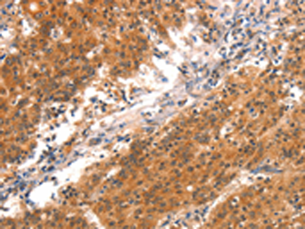 Rabbit Polyclonal Antibody to BCL3