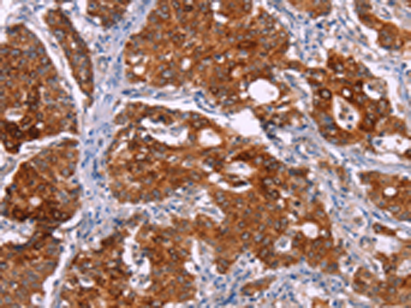 Rabbit Polyclonal Antibody to BCR