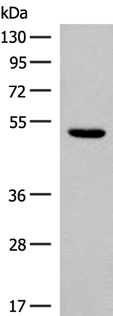 Rabbit Polyclonal Antibody to ARRB1