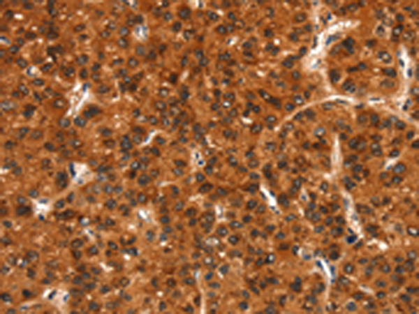 Rabbit Polyclonal Antibody to BFAR