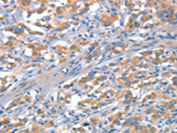 Rabbit Polyclonal Antibody to CDH5