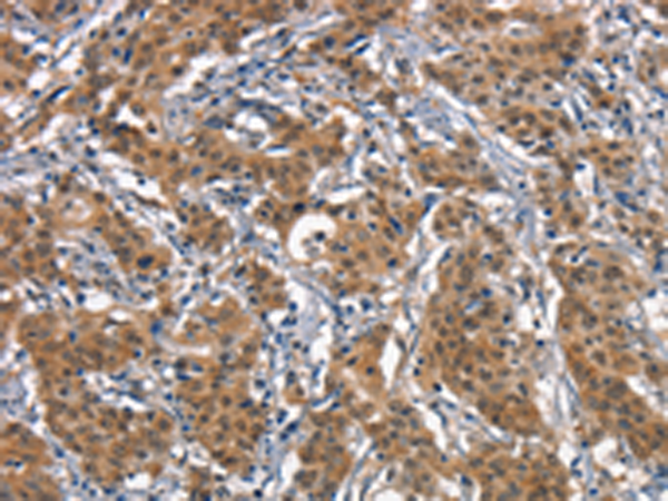 Rabbit Polyclonal Antibody to CD163