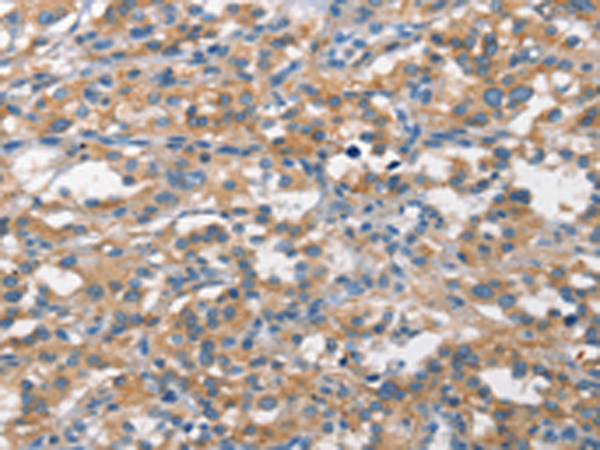 Rabbit Polyclonal Antibody to ALCAM