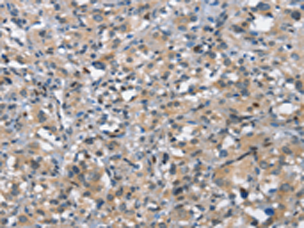 Rabbit Polyclonal Antibody to DDR2