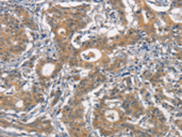 Rabbit Polyclonal Antibody to CR2