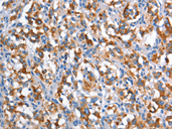 Rabbit Polyclonal Antibody to CD226