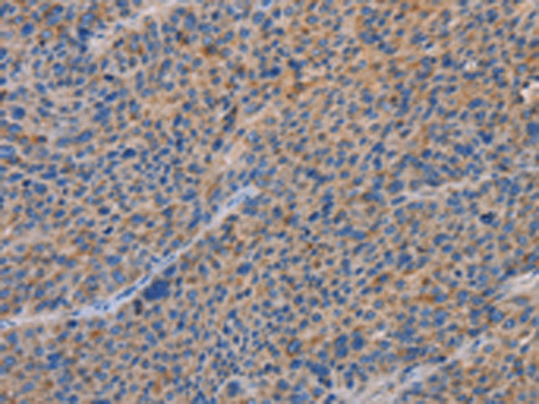 Rabbit Polyclonal Antibody to SPAG6