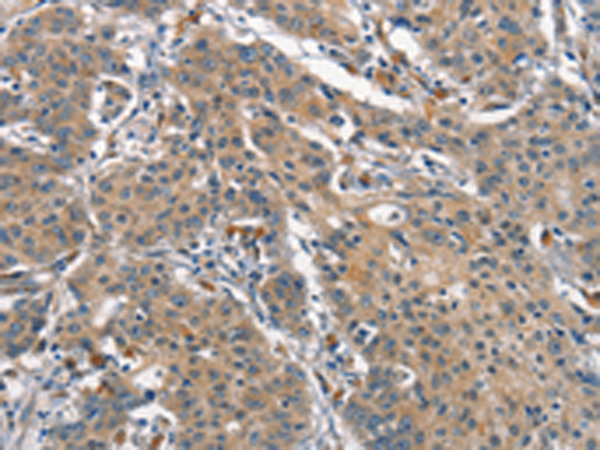 Rabbit Polyclonal Antibody to OLR1