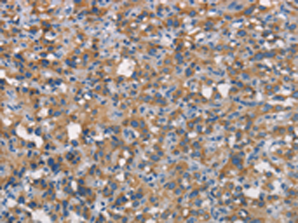 Rabbit Polyclonal Antibody to CEACAM6