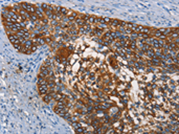 Rabbit Polyclonal Antibody to CD68