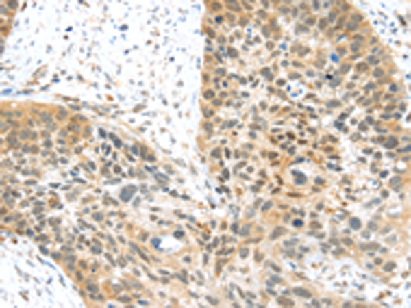 Rabbit Polyclonal Antibody to MET