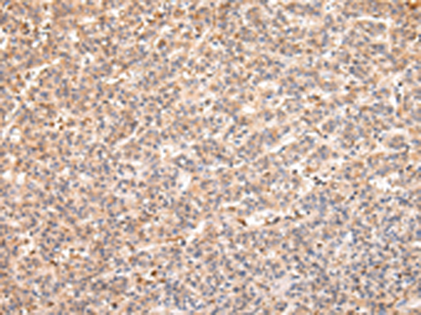 Rabbit Polyclonal Antibody to RERE
