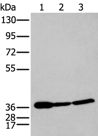 Rabbit Polyclonal Antibody to P2RY11