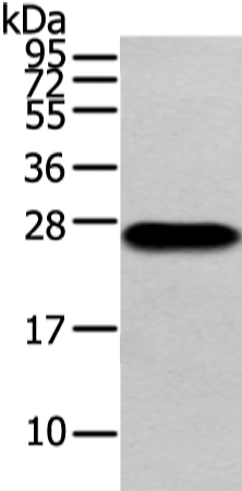 Rabbit Polyclonal Antibody to Lambda Light chain