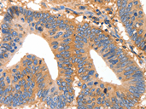 Rabbit Polyclonal Antibody to MUC6