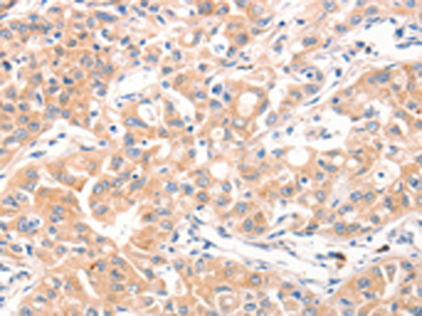 Rabbit Polyclonal Antibody to MUC2
