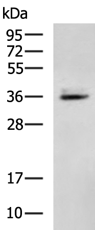 Rabbit Polyclonal Antibody to TRIM63