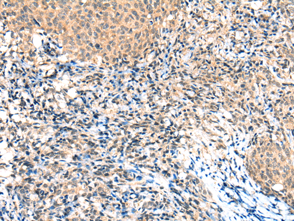 Rabbit Polyclonal Antibody to NCOR2