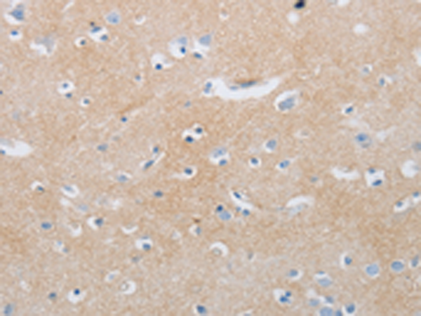 Rabbit Polyclonal Antibody to MME
