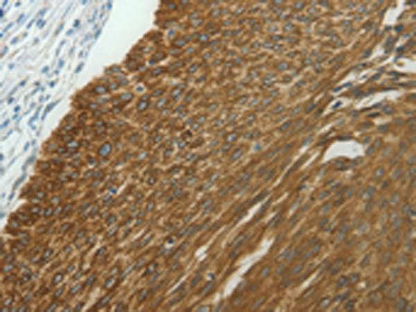 Rabbit Polyclonal Antibody to NDRG2