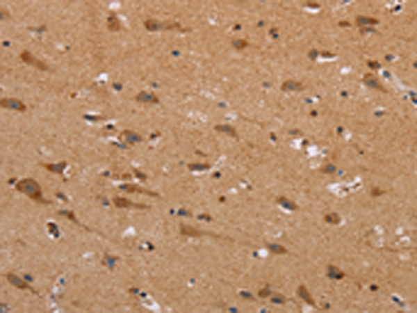 Rabbit Polyclonal Antibody to NDRG3