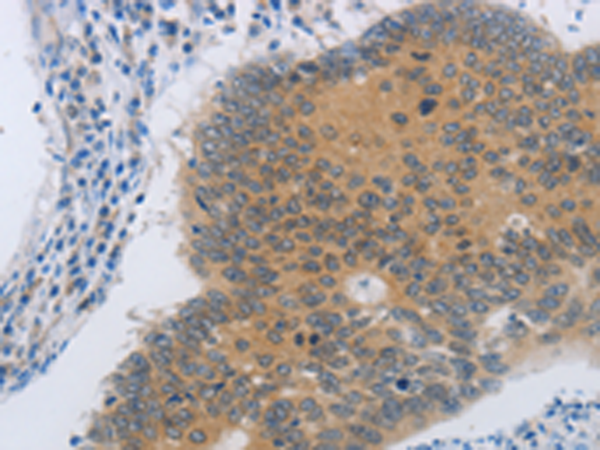 Rabbit Polyclonal Antibody to NDRG4