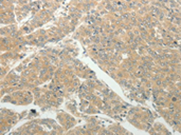 Rabbit Polyclonal Antibody to SLC8A3