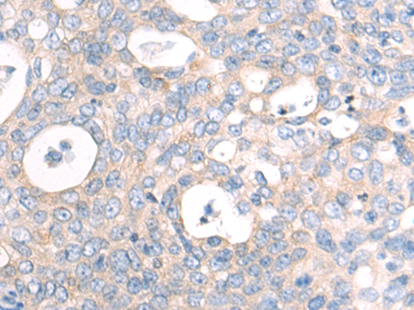 Rabbit Polyclonal Antibody to NFKB2