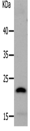 Rabbit Polyclonal Antibody to LCN2