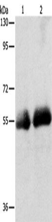 Rabbit Polyclonal Antibody to SLC5A5