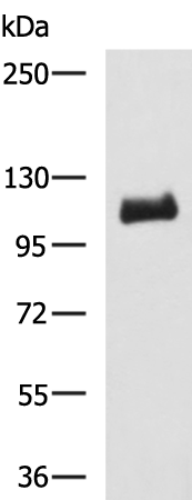 Rabbit Polyclonal Antibody to NOTCH2