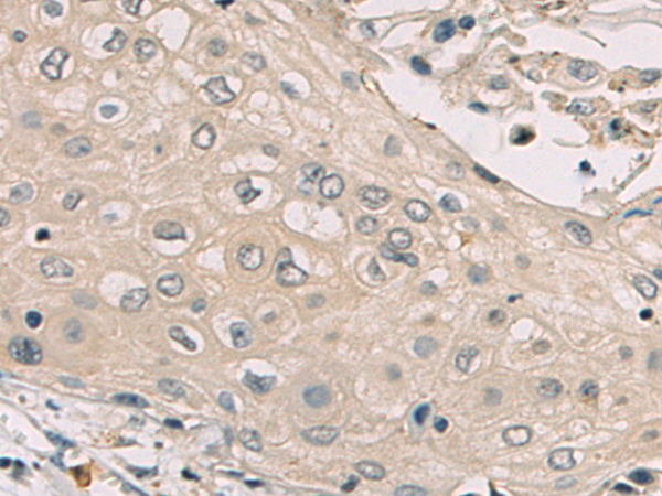 Rabbit Polyclonal Antibody to NOTCH4