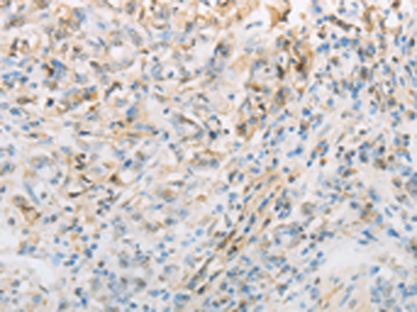 Rabbit Polyclonal Antibody to NPPC