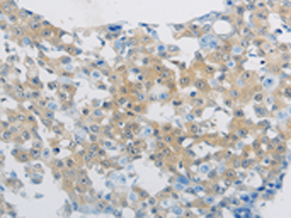 Rabbit Polyclonal Antibody to CLEC4C