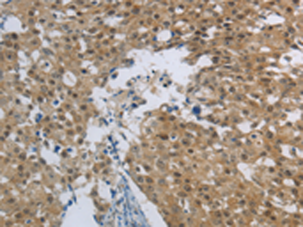 Rabbit Polyclonal Antibody to HMGN5