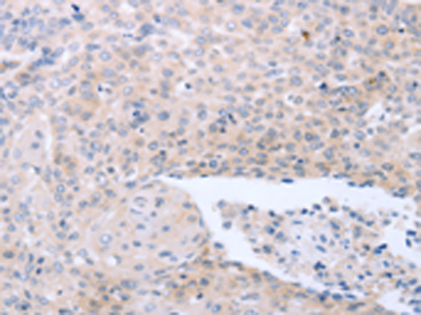 Rabbit Polyclonal Antibody to NRTN